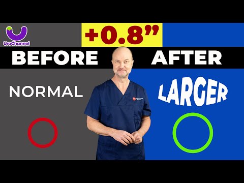 REALISTIC GAINS from PENILE STRETCHING | UroChannel