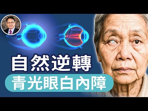 白內障、青光眼不用手術？自然逆轉？兩位患者的親身見證與科學整合方法｜四維健康