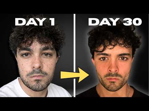 I Was Ugly... So I Looksmaxxed for 30 Days