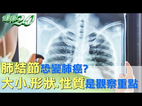 肺結節恐變肺癌? 大小.形狀.性質是觀察重點 健康2.0 @tvbshealth20