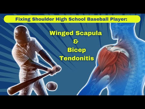 Correcting Shoulder Issues in High School Baseball Players: Winged Scapula & Bicep Tendonitis
