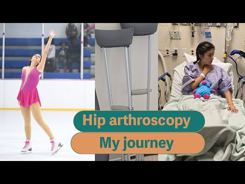 Ep 1- What to Expect from Hip Arthroscopy Labral Tear Repair Surgery (FAI)