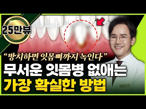 방치하면 잇몸뼈까지 녹인다. 잇몸병 없애는 가장 확실한 방법 (치주과 전문의 배승한 원장 통합)