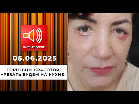 Торговцы красотой. Эпизод 3: "Резать будем на кухне". Пусть говорят. Выпуск от 05.06.2025