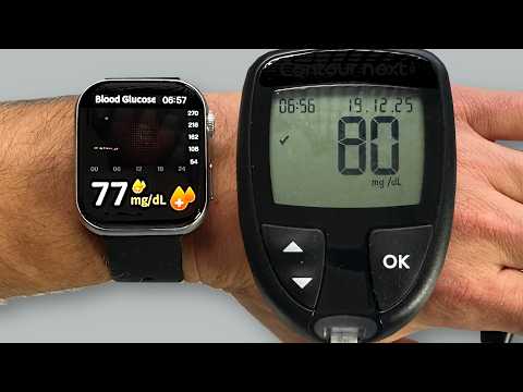 SmartWatch vs Blood Glucose Meter — I’m shocked!