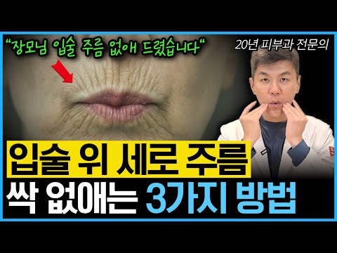 “나이 들어보이는 주범” 입술 위 인중 세로주름, 치마주름, 고양이 주름 없애는 가장 확실한 방법을 20년차 전문의가 알려드립니다.