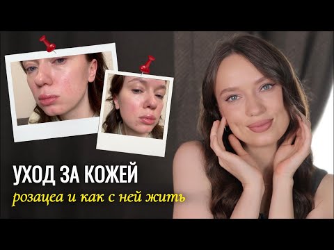 Уход за кожей лица | Уход за чувствительной кожей с розацеа