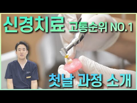 신경치료 중 가장 고통이 심한 첫날! 😪신경치료를 앞두고 계신분들! 모형을 통한 설명과 기본적인 루틴에 대해 보여드립니다.