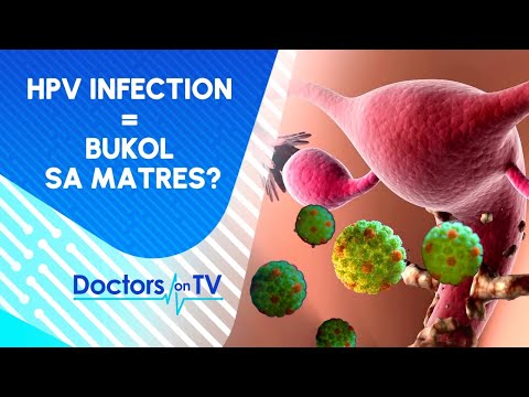 Ano ang sanhi ng pagkakaroon ng bukol sa matres o cervical cancer?