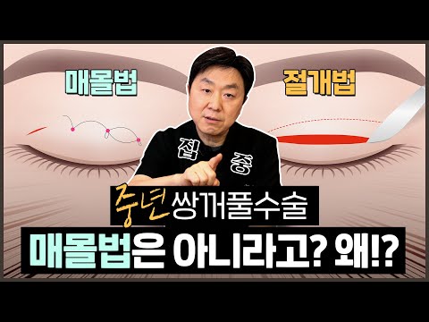 매몰쌍수vs절개쌍수, 중년에는 무조건 절개법이라고? 왜? ㅣ 매몰쌍수vs절개쌍수 고민 이 영상으로 종결! - 의학박사 백승준