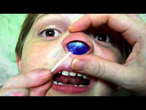 a ball got stuck in his nose..