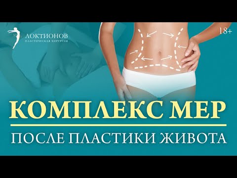 Как получить хороший результат после абдоминопластики? / 18+