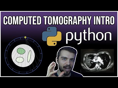 CT Scans and Tomographic Recon in PYTHON