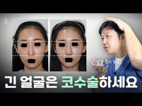 If you are worried about your flat ⭕long face, long nose⭕! You can get a 'nose job' like this!