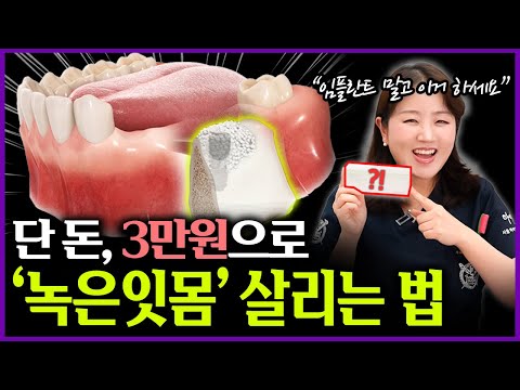 임플란트 하지마세요! '3만원'으로 내려간 잇몸뼈 재생시키는 잇몸약 알려드릴게요!