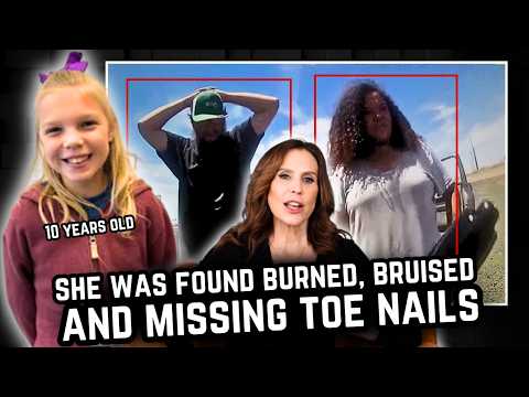 She Was Found Burned, Bruised And Missing Toe Nails