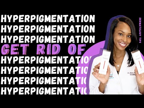 How to get rid of Hyperpigmentation, Dark Spots and Melasma