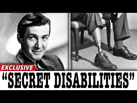 10 Old Hollywood Stars Who Hid SHOCKING Deformities and Disabilities