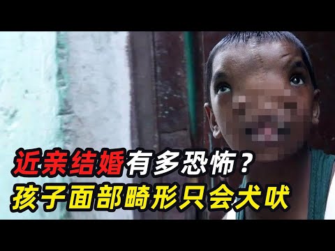 一口气看完17个畸形人，美国最恐怖近亲家族，孩子面部畸形只会犬吠？