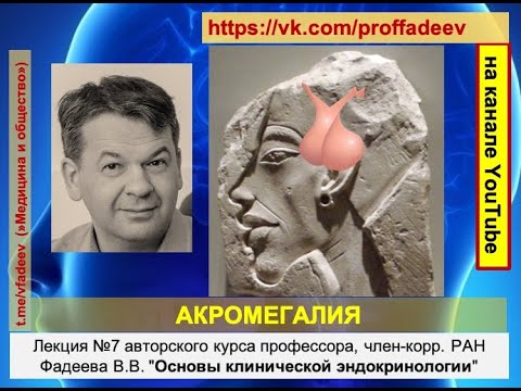 АКРОМЕГАЛИЯ