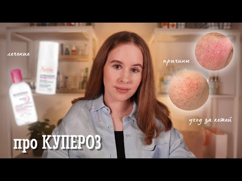 КУПЕРОЗ: причины, уход, методы коррекции