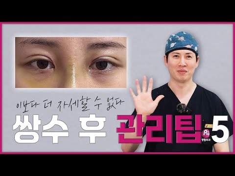 쌍수 후 눈뜨는 연습, 방법까지 알려드립니다!! 쌍수 후 관리법을 이렇게 자세히 알려준다고?! | 고민 팝팝! 팝에게 묻고 싶다!