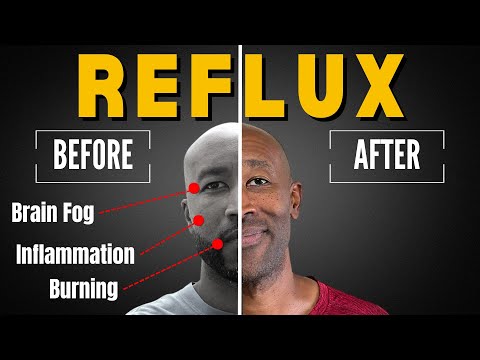 Betaine HCl Changed My Life