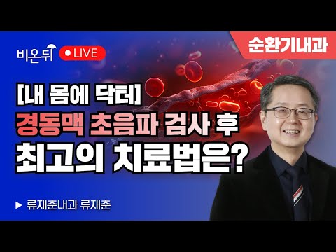 What is the best treatment after the carotid artery ultrasound? /Ryu Jae-chun, Internal Medicine
