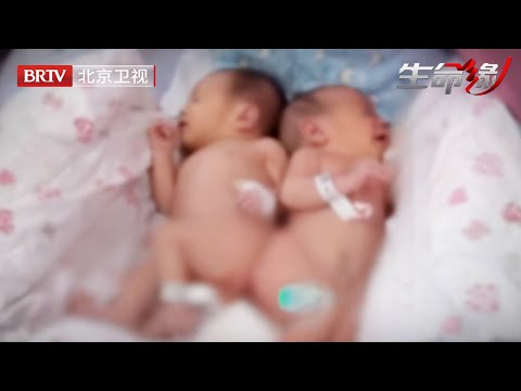 女子求子7年生下双胞胎，医生看一眼后当场吓坏，两婴儿竟共用一个肛门，复旦大学20名专家紧急抢救【生命缘第3季】