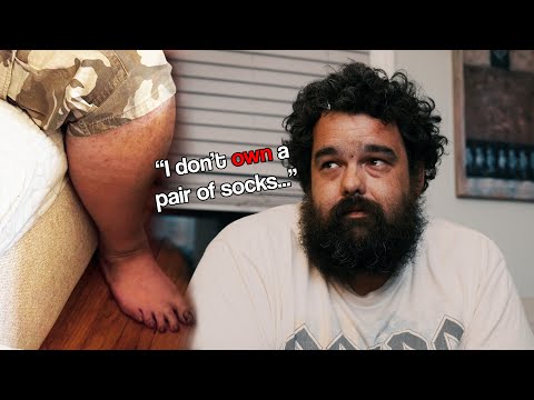 Schizophrenic Foot Fungus Pred Reveals his Darkest Secret...