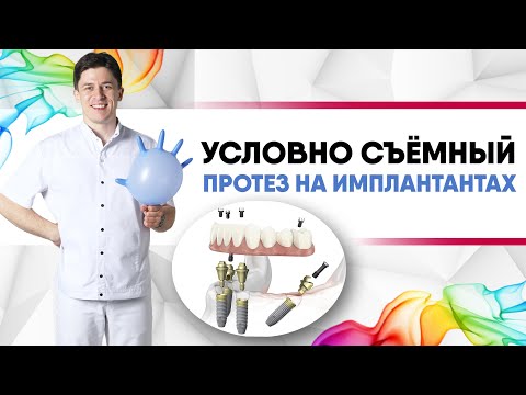 Условно съёмный протез на имплантантах [ All-on-four, All-on-six, Всё на четырёх, Всё на шести ].