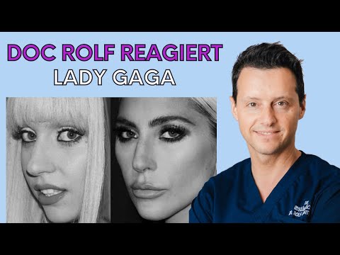 Hat sich LADY GAGA SCHÖNHEITSOPERATIONEN unterzogen?! Dr. Rolf Bartsch reagiert