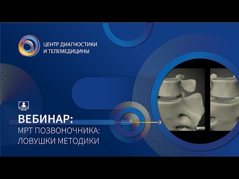 МРТ позвоночника:  ловушки методики