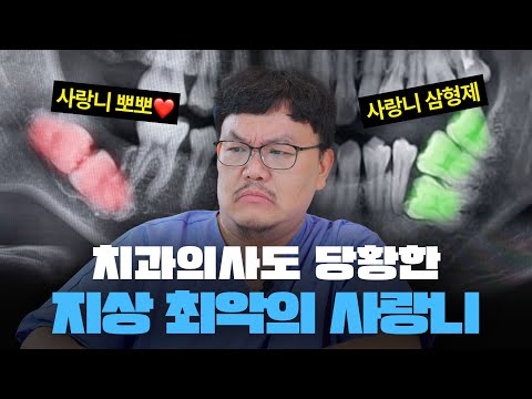 레전드 사랑니 짤들을 본 진짜 치과의사의 반응 ㅋㅋㅋㅋ