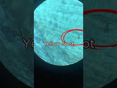 How many worms are in your sushi?