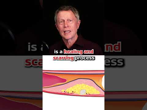 You Are Taking Vitamin K2 For The Wrong Reason