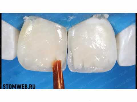 Cиликоновый ключ