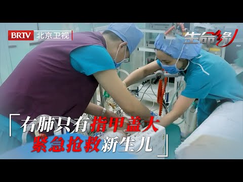 新生儿检查结果惊呆医生，右肺只有指甲盖大小，出生不到一分钟就被插管【生命缘第9季】