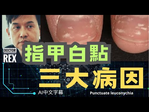 指甲出現白點: 你不知道的三大病因