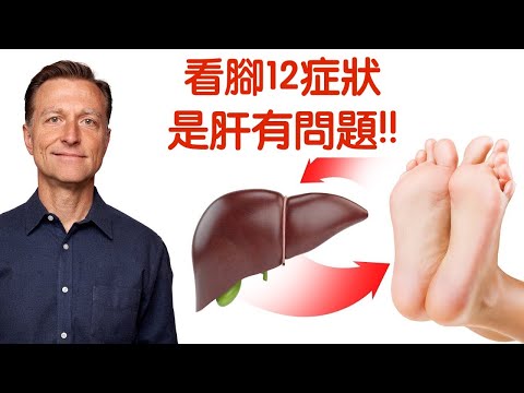 看腳的12症狀是肝問題,保健肝6方法,柏格醫生 Dr Berg