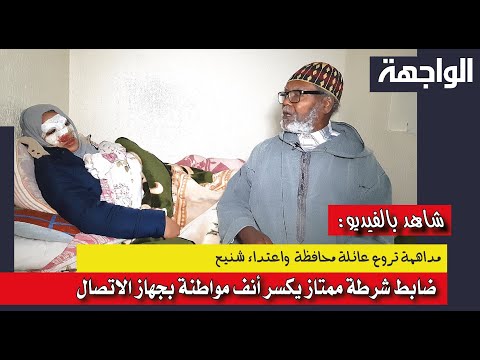 مداهمة تروع عائلة محافظة وضابط شرطة ممتاز يكسر أنف مواطنة بجهاز الاتصال