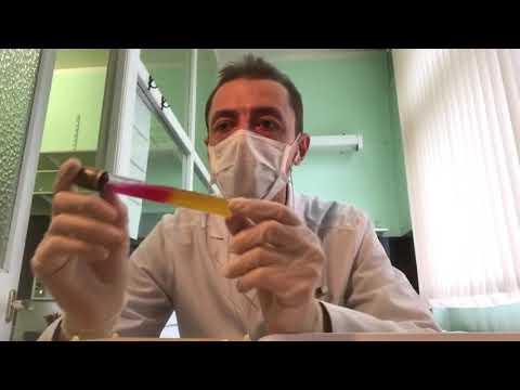 Как распознать бактерии рода Shigella (шигелла). Подробный лабораторный обзор (2020).