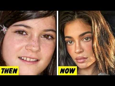 30 Celebrity Transformations You Have To See To Believe (Then vs Now)