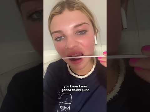 They BULLIED Her Into Doing This To Her Teeth… *serious*