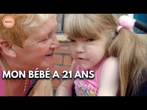 Le syndrome de Turner | DOC COMPLET