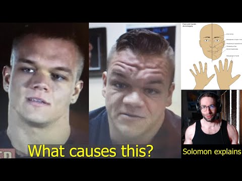 What ACTUALLY Causes 'Fat-Head' From Juicing?