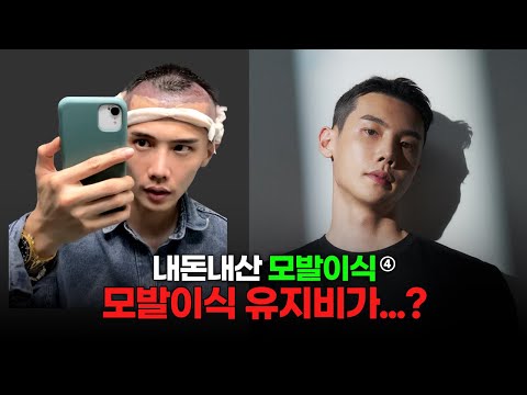 모발이식후기4 모발이식 이래도 하시겠습니까?