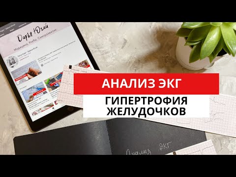 ЭКГ при гипертрофии желудочков. ГЛЖ. ГПЖ. (Гипертрофия левого и правого желудочков).