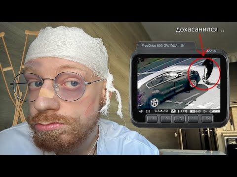 КАК ОДНАЖДЫ Я ПОПАЛ В ДТП НА ЭЛЕКТРОСАМОКАТЕ и почему я теперь их ненавижу... (влетел прям в машину)