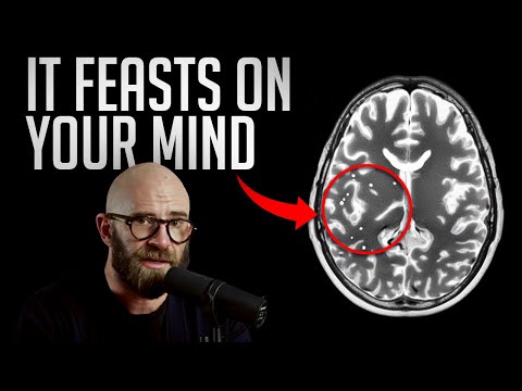 Brain-Eating Amoeba: the World’s Most Terrifying Parasite